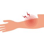 آیا درد دست چپ همیشه بی‌ خطر است؟ بررسی علل شایع و روش‌ های درمان