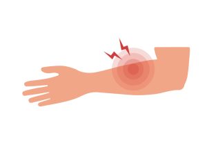 آیا درد دست چپ همیشه بی‌ خطر است؟ بررسی علل شایع و روش‌ های درمان