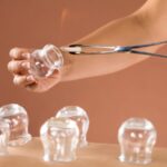 بهترین زمان حجامت؛ توصیه‌ های پزشکی و شرایط فردی