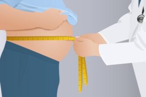 چاقی؛ یک بیماری مزمن و تهدیدی برای سلامت عمومی بدن