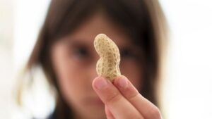 راهکارهای نوین برای کاهش خطر آلرژی بادام‌ زمینی در کودکان خردسال
