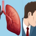 علائم سرطان ریه چیست؟ سرفه مداوم و نشانه هایی که نباید نادیده بگیرید